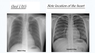 Chest X RAY:
Male X Ray
Female X Ray
Note location of the heart
 