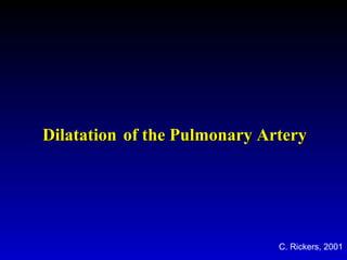 DilatationDilatation of the Pulmonary Arteryof the Pulmonary Artery
C. Rickers, 2001
 