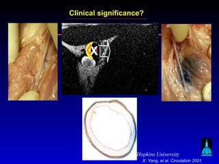 Johns Hopkins University
BA
X
Clinical significance?
X. Yang, et al. Circulation 2001
 