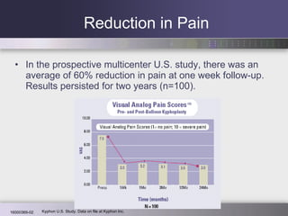 Reduction in Pain In the prospective multicenter U.S. study, there was an average of 60% reduction in pain at one week follow-up. Results persisted for two years (n=100).  Kyphon U.S. Study. Data on file at Kyphon Inc. 