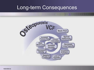 Long-term Consequences 