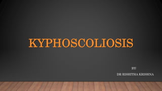 KYPHOSCOLIOSIS
BY:
DR RISHITHA KRISHNA
 