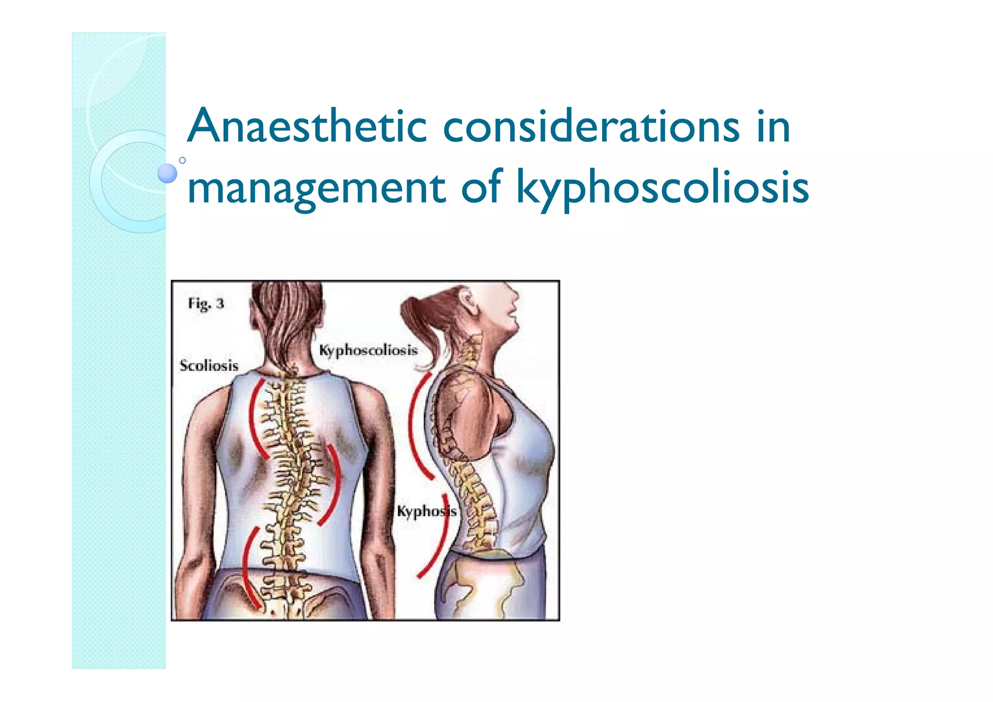 kyphoscoliosis1-pdf