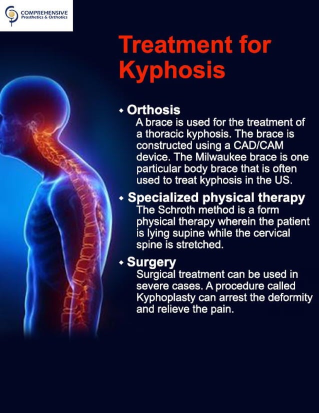 Kyphosis | PDF