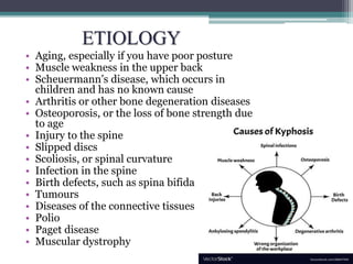 ETIOLOGY
• Aging, especially if you have poor posture
• Muscle weakness in the upper back
• Scheuermann’s disease, which occurs in
children and has no known cause
• Arthritis or other bone degeneration diseases
• Osteoporosis, or the loss of bone strength due
to age
• Injury to the spine
• Slipped discs
• Scoliosis, or spinal curvature
• Infection in the spine
• Birth defects, such as spina bifida
• Tumours
• Diseases of the connective tissues
• Polio
• Paget disease
• Muscular dystrophy
 