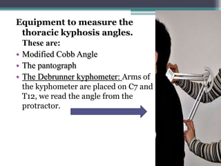 Equipment to measure the
thoracic kyphosis angles.
These are:
• Modified Cobb Angle
• The pantograph
• The Debrunner kyphometer: Arms of
the kyphometer are placed on C7 and
T12, we read the angle from the
protractor.
 