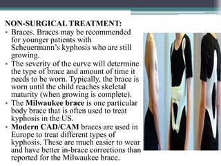 NON-SURGICAL TREATMENT:
• Braces. Braces may be recommended
for younger patients with
Scheuermann’s kyphosis who are still
growing.
• The severity of the curve will determine
the type of brace and amount of time it
needs to be worn. Typically, the brace is
worn until the child reaches skeletal
maturity (when growing is complete).
• The Milwaukee brace is one particular
body brace that is often used to treat
kyphosis in the US.
• Modern CAD/CAM braces are used in
Europe to treat different types of
kyphosis. These are much easier to wear
and have better in-brace corrections than
reported for the Milwaukee brace.
 