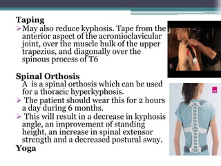 Taping
May also reduce kyphosis. Tape from the
anterior aspect of the acromioclavicular
joint, over the muscle bulk of the upper
trapezius, and diagonally over the
spinous process of T6
Spinal Orthosis
A is a spinal orthosis which can be used
for a thoracic hyperkyphosis.
 The patient should wear this for 2 hours
a day during 6 months.
 This will result in a decrease in kyphosis
angle, an improvement of standing
height, an increase in spinal extensor
strength and a decreased postural sway.
Yoga
 