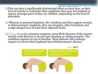 This can have a significantly detrimental effect on their lives, as their
level of activity is curbed by their condition; they may feel isolated or
uneasy amongst peers if they are children, depending on the level of
deformity.
 Whereas in postural kyphosis, the vertebrae and discs appear normal,
in Scheuermann's kyphosis, they are irregular, often herniated, and
wedge-shaped over at least three adjacent levels.
Fatigue is a very common symptom, most likely because of the intense
muscle work that has to be put into standing or sitting properly. The
condition appears to run in families. Most patients who undergo
surgery to correct their kyphosis have Scheuermann's disease.
 