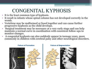CONGENITAL KYPHOSIS
• It is the least common type of kyphosis.
• It result in infants whose spinal column has not developed correctly in the
womb.
• Vertebrae may be malformed or fused together and can cause further
progressive kyphosis as the child develops.
• Surgical treatment may be necessary at a very early stage and can help
maintain a normal curve in coordination with consistent follow-ups to
monitor changes.
• A congenital kyphosis can also suddenly appear in teenage years, more
commonly in children with cerebral palsy and other neurological disorders.
 