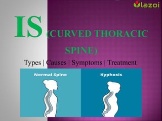 Types | Causes | Symptoms | Treatment
 