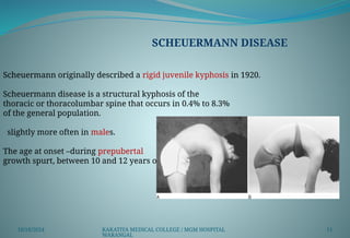 KYPHOSIS.pptx KYPHOSIS DEFORMITY OF THE SPINE | PPTX