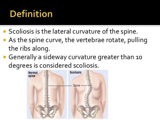 Kyphosis lordosis