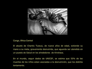 Congo, África Central

El abuelo de Chantis Tuseuo, de nueve años de edad, extiende su
mano a su nieta, gravemente desnutrida, que aguarda ser atendida en
un puesto de Salud en los alrededores de Kinshasa.


En el mundo, segun dados de UNICEF, se estima que 55% de las
muertes de los niños estan asociadas a la desnutrición, que los debilita
lentamente.
 