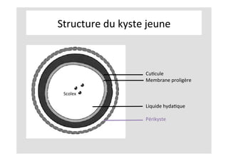 Structure	du	kyste	jeune	
	
	
CuKcule	
Membrane	proligère	
	
	
	
Liquide	hydaKque	
	
Périkyste	
	
Scolex	
 