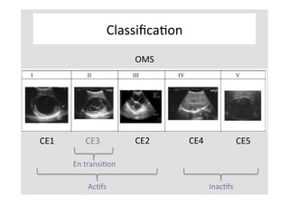 ClassiﬁcaKon	
CE1	 CE3	 CE2	 CE4	 CE5	
En	transiKon	
AcKfs	 InacKfs	
OMS		
 
