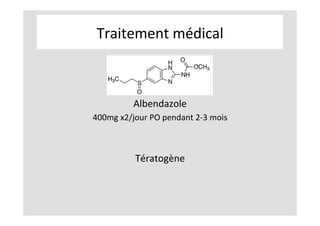 Traitement	médical	
	
	
	
Albendazole	
400mg	x2/jour	PO	pendant	2-3	mois	
	
	
Tératogène	
	
	
	
	
 
