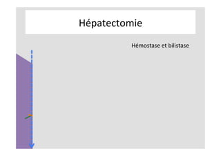 Hépatectomie	
Hémostase	et	bilistase	
	
	
 