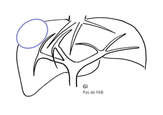 GI	
Pas	de	FKB	
 