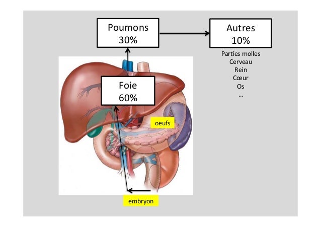 Kyste hydatique du foie Kyste hydatique du foie