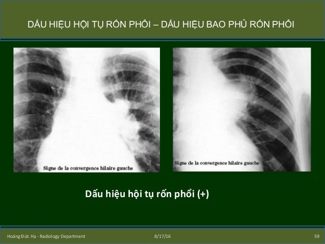 Image result for dáº¥u há»i tá»¥