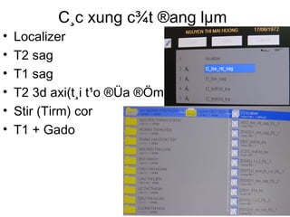 Ky thuat chup mri cstl | PPT