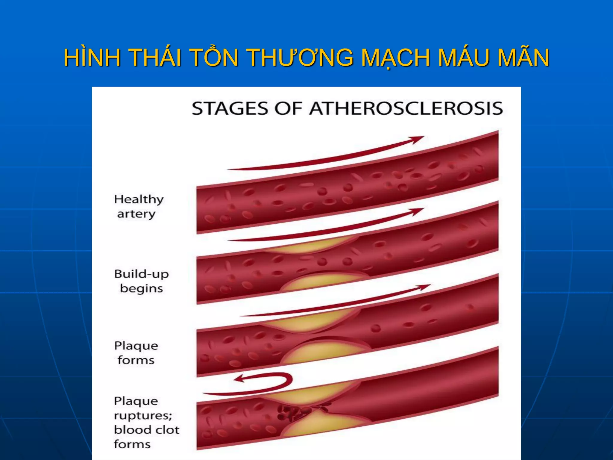 HÌNH THÁI TỔN THƯƠNG MẠCH MÁU MÃN
 