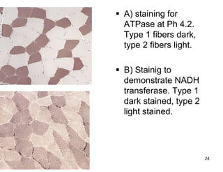 09/01/2023 24
 A) staining for
ATPase at Ph 4.2.
Type 1 fibers dark,
type 2 fibers light.
 B) Stainig to
demonstrate NADH
transferase. Type 1
dark stained, type 2
light stained.
 
