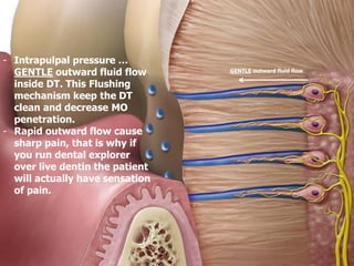 - Intrapulpal pressure …
GENTLE outward fluid flow
inside DT. This Flushing
mechanism keep the DT
clean and decrease MO
penetration.
- Rapid outward flow cause
sharp pain, that is why if
you run dental explorer
over live dentin the patient
will actually have sensation
of pain.
outward fluid flow
GENTLE
 