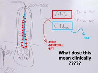 -COLD
-DENTINAL
-EPT
HEAT
What dose this
mean clinically
?????
 