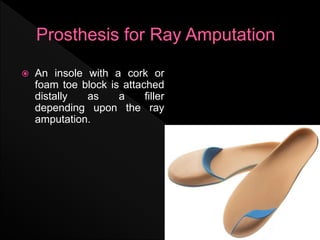 L.L Prosthetics.pptx