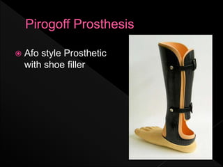  Afo style Prosthetic
with shoe filler
 