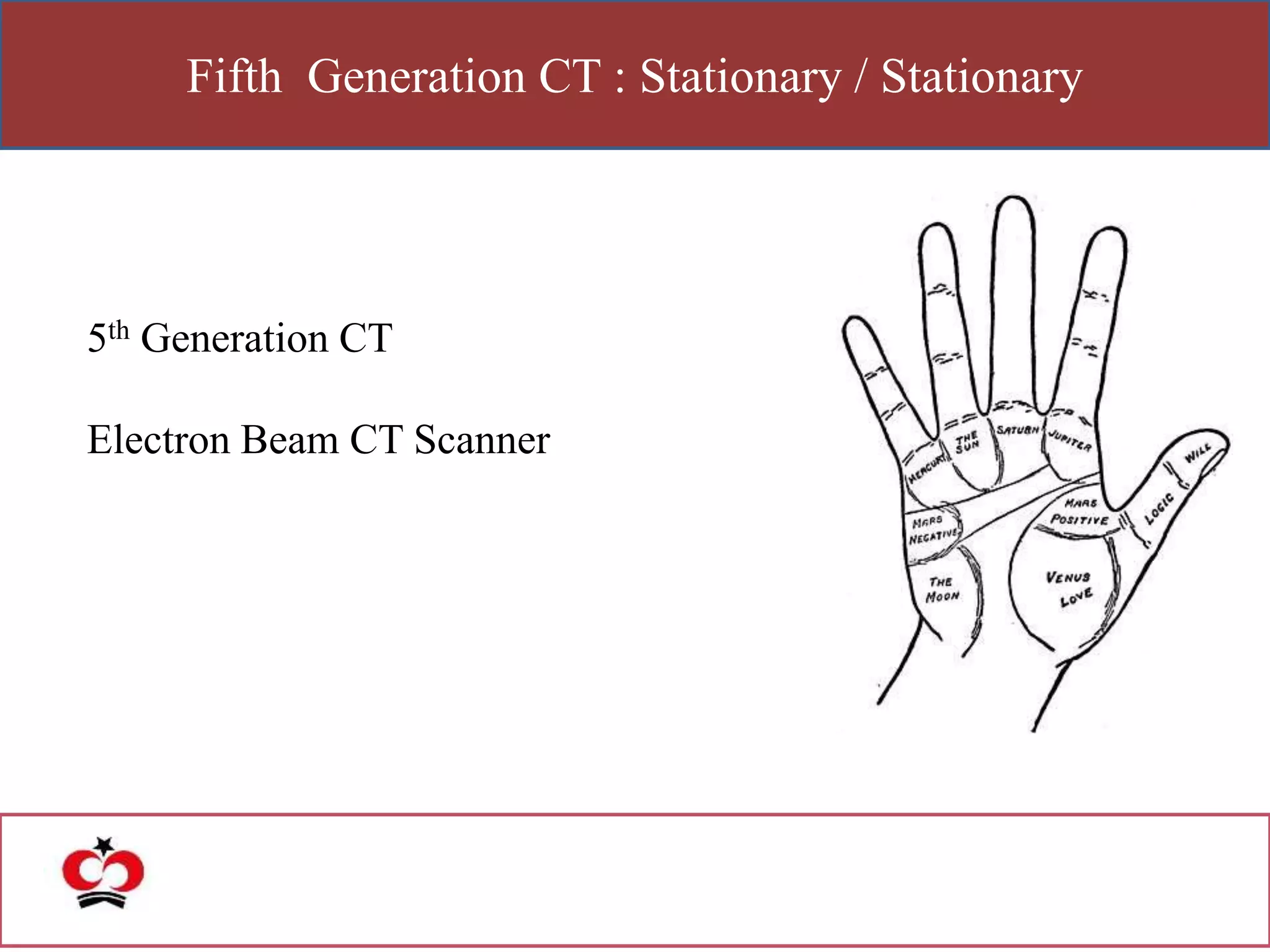 Fifth Generation CT : Stationary / Stationary
5th Generation CT
Electron Beam CT Scanner
 