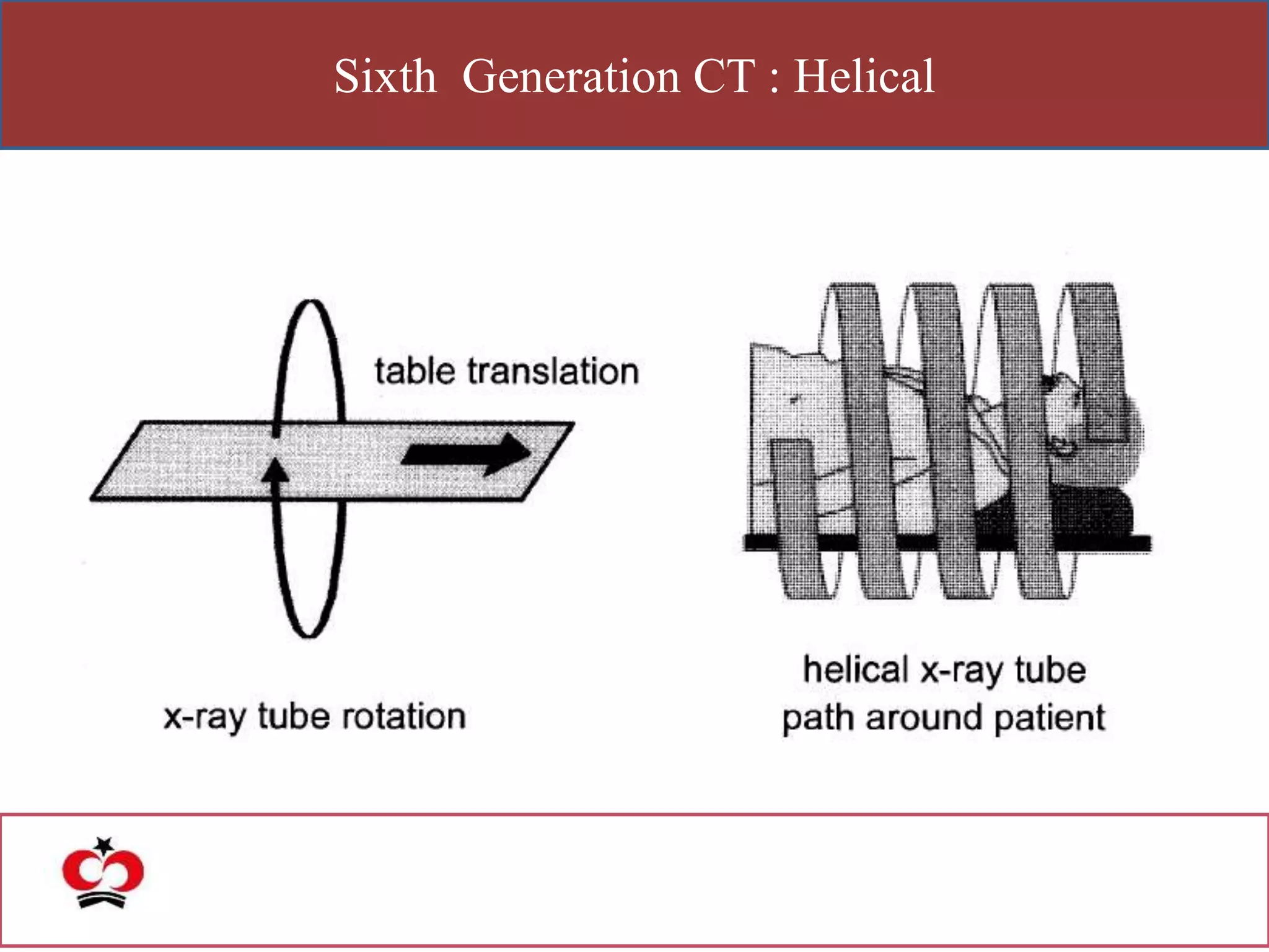 Sixth Generation CT : Helical
 