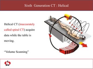 Sixth Generation CT : Helical
Helical CT (inaccurately
called spiral CT) acquire
data while the table is
moving.
“Volume Scanning”
 