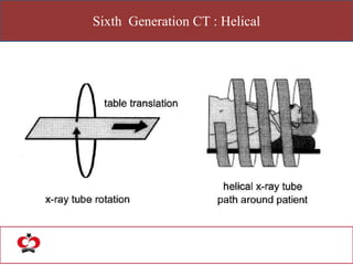Sixth Generation CT : Helical
 