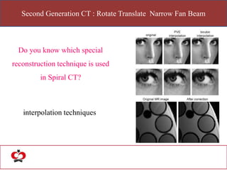 Second Generation CT : Rotate Translate Narrow Fan Beam
Do you know which special
reconstruction technique is used
in Spiral CT?
interpolation techniques
 