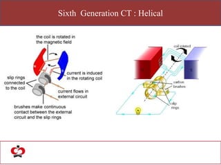 Sixth Generation CT : Helical
 