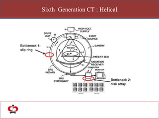 Sixth Generation CT : Helical
 