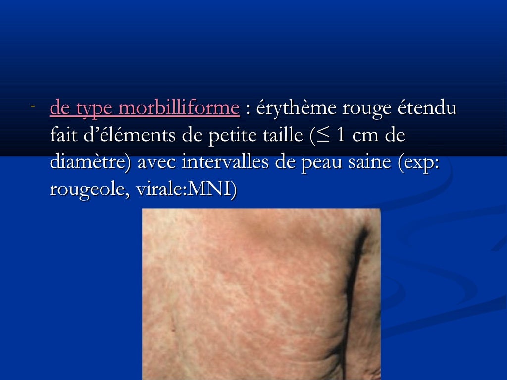 Lésions élémentaires en dermatologie
