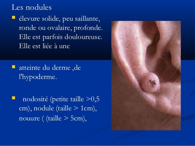 Lésions élémentaires en dermatologie
