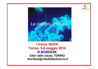 La cianosi cronica
I Corso GUCH
Torino, 5-6 maggio 2014
R BORDESE
Citta’ della salute, TORINO
rbordese@cittadellasalute.to.it
 