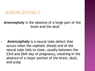 Anencephaly is the absence of a large part of the
brain and the skull



Anencephaly is a neural tube defect that
occurs when the cephalic (head) end of the
neural tube fails to close, usually between the
23rd and 26th day of pregnancy, resulting in the
absence of a major portion of the brain, skull,
and scalp

 
