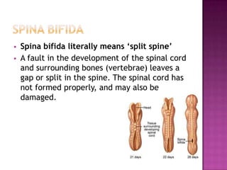 


Spina bifida literally means ‘split spine’
A fault in the development of the spinal cord
and surrounding bones (vertebrae) leaves a
gap or split in the spine. The spinal cord has
not formed properly, and may also be
damaged.

 