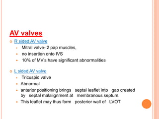 AV valves
 R sided AV valve
 Mitral valve- 2 pap muscles,
 no insertion onto IVS
 10% of MV's have significant abnormalities
 L sided AV valve
 Tricuspid valve
 Abnormal
 anterior positioning brings septal leaflet into gap created
by septal malalignment at membranous septum.
 This leaflet may thus form posterior wall of LVOT
 