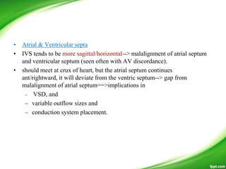 • Atrial & Ventricular septa
• IVS tends to be more sagittal/horizontal--> malalignment of atrial septum
and ventricular septum (seen often with AV discordance).
• should meet at crux of heart, but the atrial septum continues
ant/rightward, it will deviate from the ventric septum--> gap from
malalignment of atrial septum==>implications in
– VSD, and
– variable outflow sizes and
– conduction system placement.
 