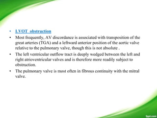 • LVOT obstruction
• Most frequently, AV discordance is associated with transposition of the
great arteries (TGA) and a leftward anterior position of the aortic valve
relative to the pulmonary valve, though this is not absolute .
• The left ventricular outflow tract is deeply wedged between the left and
right atrioventricular valves and is therefore more readily subject to
obstruction.
• The pulmonary valve is most often in fibrous continuity with the mitral
valve.
 