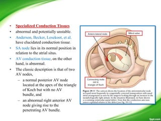 • Specialized Conduction Tissues
• abnormal and potentially unstable.
• Anderson, Becker, Losekoot, et al.
have elucidated conduction tissue.
• SA node lies in its normal position in
relation to the atrial situs.
• AV conduction tissue, on the other
hand, is abnormal.
• The classic description is that of two
AV nodes,
– a normal posterior AV node
located at the apex of the triangle
of Koch but with no AV
bundle, and
– an abnormal right anterior AV
node giving rise to the
penetrating AV bundle.
 