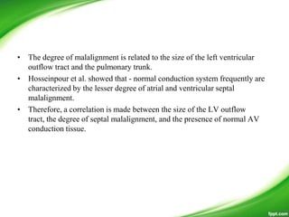 • The degree of malalignment is related to the size of the left ventricular
outflow tract and the pulmonary trunk.
• Hosseinpour et al. showed that - normal conduction system frequently are
characterized by the lesser degree of atrial and ventricular septal
malalignment.
• Therefore, a correlation is made between the size of the LV outflow
tract, the degree of septal malalignment, and the presence of normal AV
conduction tissue.
 