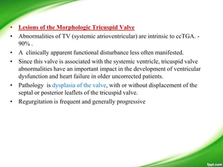 • Lesions of the Morphologic Tricuspid Valve
• Abnormalities of TV (systemic atrioventricular) are intrinsic to ccTGA. -
90% .
• A clinically apparent functional disturbance less often manifested.
• Since this valve is associated with the systemic ventricle, tricuspid valve
abnormalities have an important impact in the development of ventricular
dysfunction and heart failure in older uncorrected patients.
• Pathology is dysplasia of the valve, with or without displacement of the
septal or posterior leaflets of the tricuspid valve.
• Regurgitation is frequent and generally progressive
 